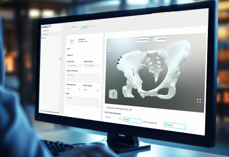 Axial3D & GE HealthCare Sign MoU for Personalized Orthopedic 3D Printing
